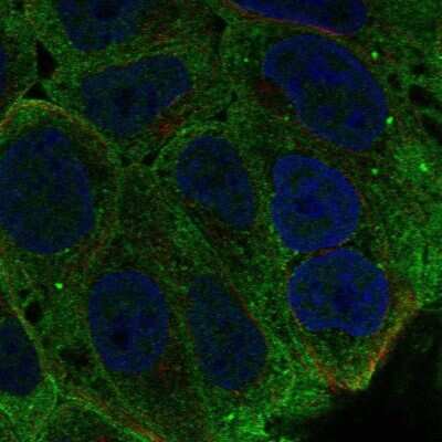 Immunocytochemistry/ Immunofluorescence: HAI-1/HGFA Inhibitor 1 Antibody [NBP2-68621]