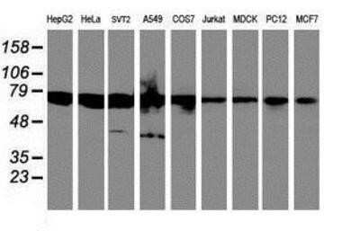 Western Blot: HAI-1/HGFA Inhibitor 1 Antibody (OTI4H2)Azide and BSA Free [NBP2-71296]