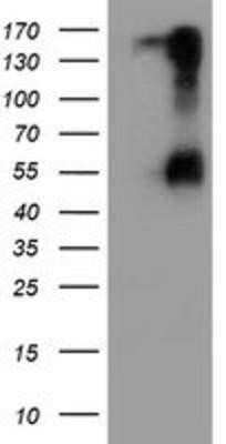 Western Blot: HAI-1/HGFA Inhibitor 1 Antibody (OTI4H2)Azide and BSA Free [NBP2-71296]