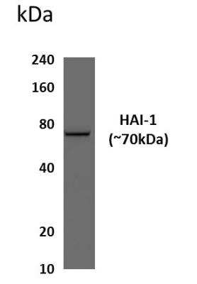 Western Blot: HAI-1/HGFA Inhibitor 1 Antibody (RM0088-3G21)Azide and BSA Free [NBP2-12356]