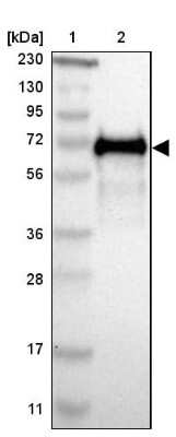 Western Blot: HAI-1/HGFA Inhibitor 1 Antibody [NBP1-89720]