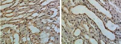 Immunohistochemistry-Paraffin: HAI-2/SPINT2 Antibody (RM0089-7F52) - Azide and BSA Free [NBP1-21728]