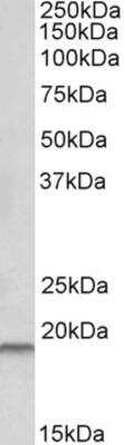 Western Blot: HAI-2/SPINT2 Antibody [NBP1-52068]