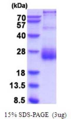 SDS-PAGE: Recombinant Human HAI-2/SPINT2 His Protein [NBP2-52114]