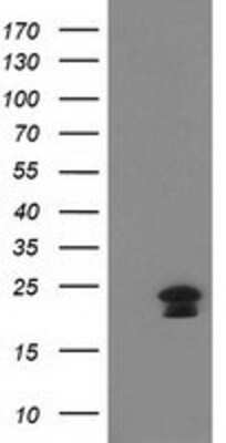 Western Blot: HAND1 Antibody (OTI1G10) [NBP2-00576]