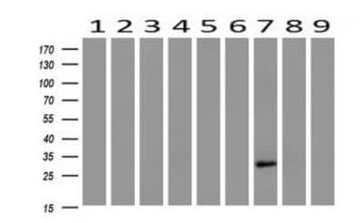 Western Blot: HAND1 Antibody (OTI1G10) [NBP2-00576]