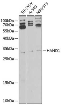 Western Blot: HAND1 AntibodyBSA Free [NBP3-04760]