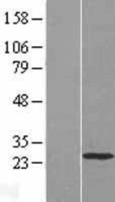 Western Blot: HAND1 Overexpression Lysate [NBL1-11442]