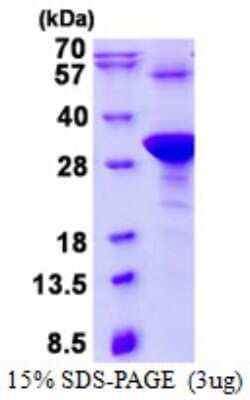 SDS-PAGE: Recombinant Human HAND1 His Protein [NBP2-23102]