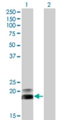 Western Blot: HAND2 Antibody (3D5) [H00009464-M06]