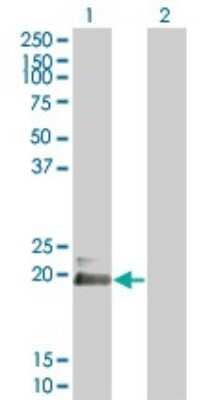 Western Blot: HAND2 Antibody (3E3) [H00009464-M03]