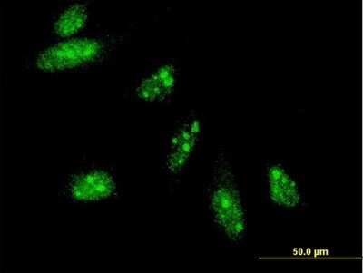 Immunocytochemistry/ Immunofluorescence: HAND2 Antibody (4D9) [H00009464-M05]