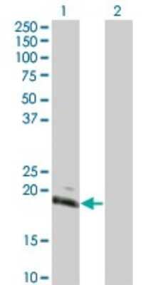 Western Blot: HAND2 Antibody (4D9) [H00009464-M05]