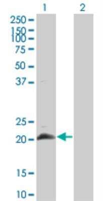 Western Blot: HAND2 Antibody (4E12) [H00009464-M04]