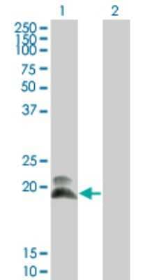 Western Blot: HAND2 Antibody (4H8) [H00009464-M01]