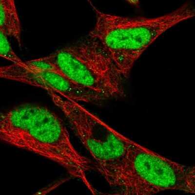 Immunocytochemistry/ Immunofluorescence: HAND2 Antibody [NBP2-58062]