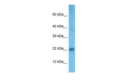 Western Blot: HAND2 Antibody [NBP1-74185]