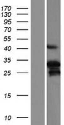 Western Blot: HAND2 Overexpression Lysate [NBP2-06491]