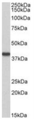 Western Blot: HAO2 Antibody [NBP2-47139]