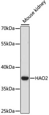 Western Blot: HAO2 AntibodyAzide and BSA Free [NBP3-04697]