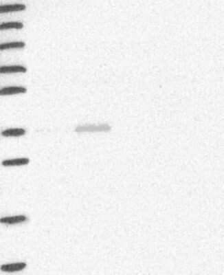 Western Blot: HAO2 Antibody [NBP3-17862]