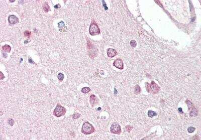 Immunohistochemistry-Paraffin: HAP1 Antibody [NB100-55413]