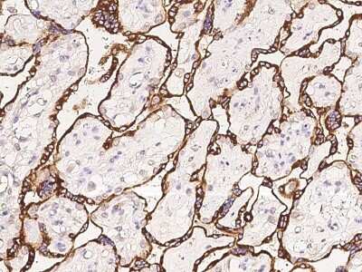 Immunohistochemistry-Paraffin: HAP1 Antibody [NBP2-98048]