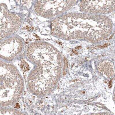 Immunohistochemistry-Paraffin: HAP40 Antibody [NBP2-54731]