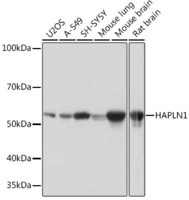 Western Blot: HAPLN1 Antibody (5O9U2) [NBP3-16486]