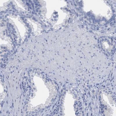 Immunohistochemistry-Paraffin: HAPLN1 Antibody [NBP1-84376]