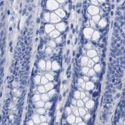 Immunohistochemistry-Paraffin: HAPLN1 Antibody [NBP1-84376]