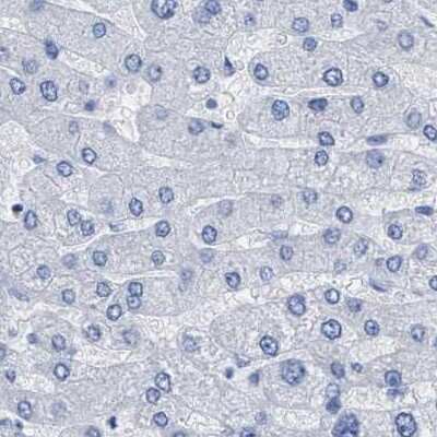 Immunohistochemistry-Paraffin: HAPLN1 Antibody [NBP1-84376]