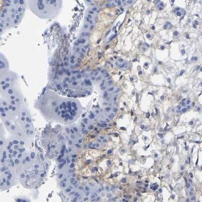 Immunohistochemistry-Paraffin: HAPLN1 Antibody [NBP1-85443]