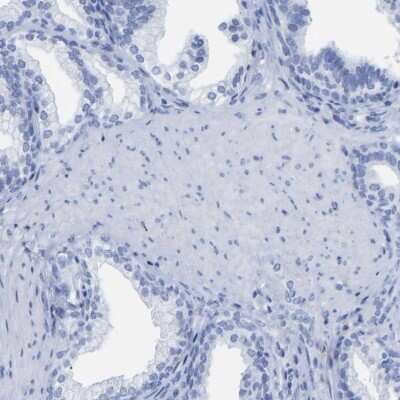 Immunohistochemistry-Paraffin: HAPLN1 Antibody [NBP1-85443]