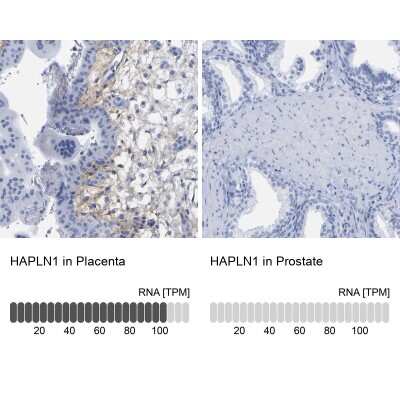 Immunohistochemistry-Paraffin: HAPLN1 Antibody [NBP1-85443]