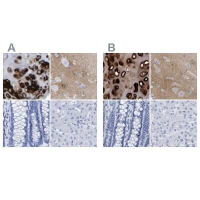 Immunohistochemistry-Paraffin: HAPLN1 Antibody [NBP1-85443]