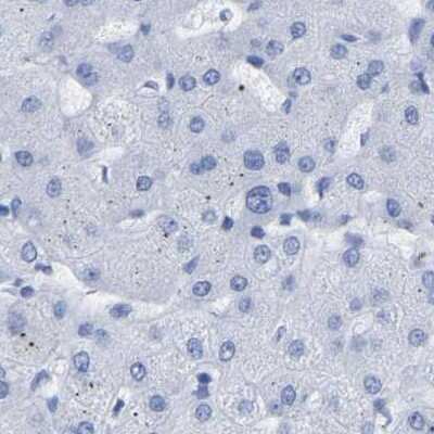 Immunohistochemistry-Paraffin: HAPLN1 Antibody [NBP1-85443]