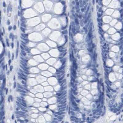 Immunohistochemistry-Paraffin: HAPLN1 Antibody [NBP1-85443]