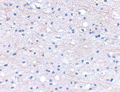 Immunohistochemistry-Paraffin: HAPLN2 Antibody - BSA Free [NBP1-77322]