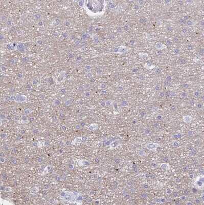 Immunohistochemistry-Paraffin: HAPLN2 Antibody [NBP1-91977]