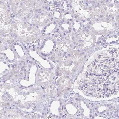 Immunohistochemistry-Paraffin: HAPLN2 Antibody [NBP1-91977]