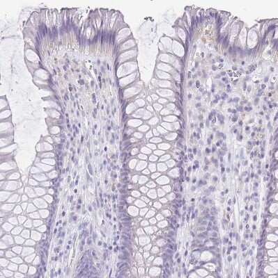 Immunohistochemistry-Paraffin: HAPLN2 Antibody [NBP1-91977]