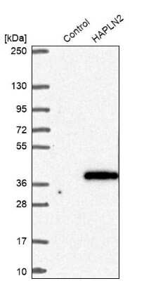 Western Blot: HAPLN2 Antibody [NBP1-91977]