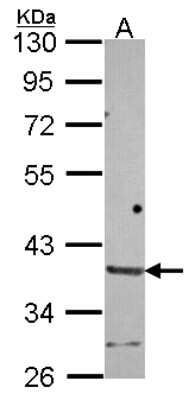 Western Blot: HAPLN2 Antibody [NBP2-16779]