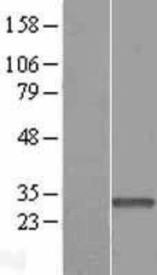 Western Blot: HAPLN2 Overexpression Lysate [NBP2-06514]