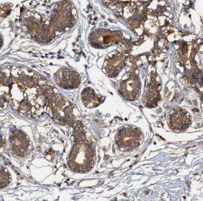 Immunohistochemistry-Paraffin: HAPLN3 Antibody [NBP1-83945]