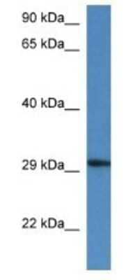 Western Blot: HARBI1 Antibody [NBP1-74230]