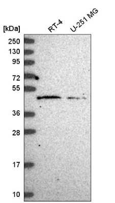 Western Blot: HARBI1 Antibody [NBP2-55680]