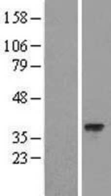 Western Blot: HARBI1 Overexpression Lysate [NBL1-11447]