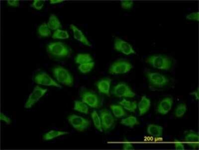 Immunocytochemistry/ Immunofluorescence: HARS Antibody (1C8) [H00003035-M01]